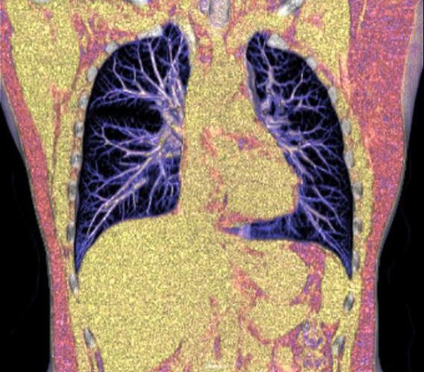 Axial and Helical Scan