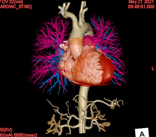 One-stop CT Examination