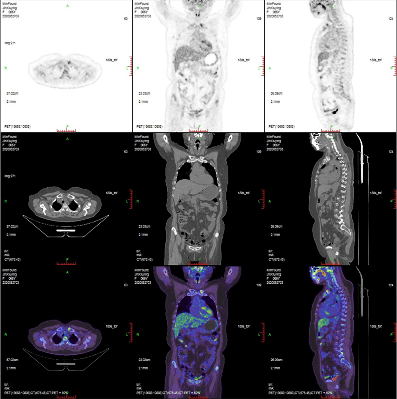 Clinical case 4