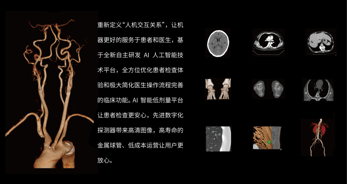 繁星&銀河&天琴CT系列.png