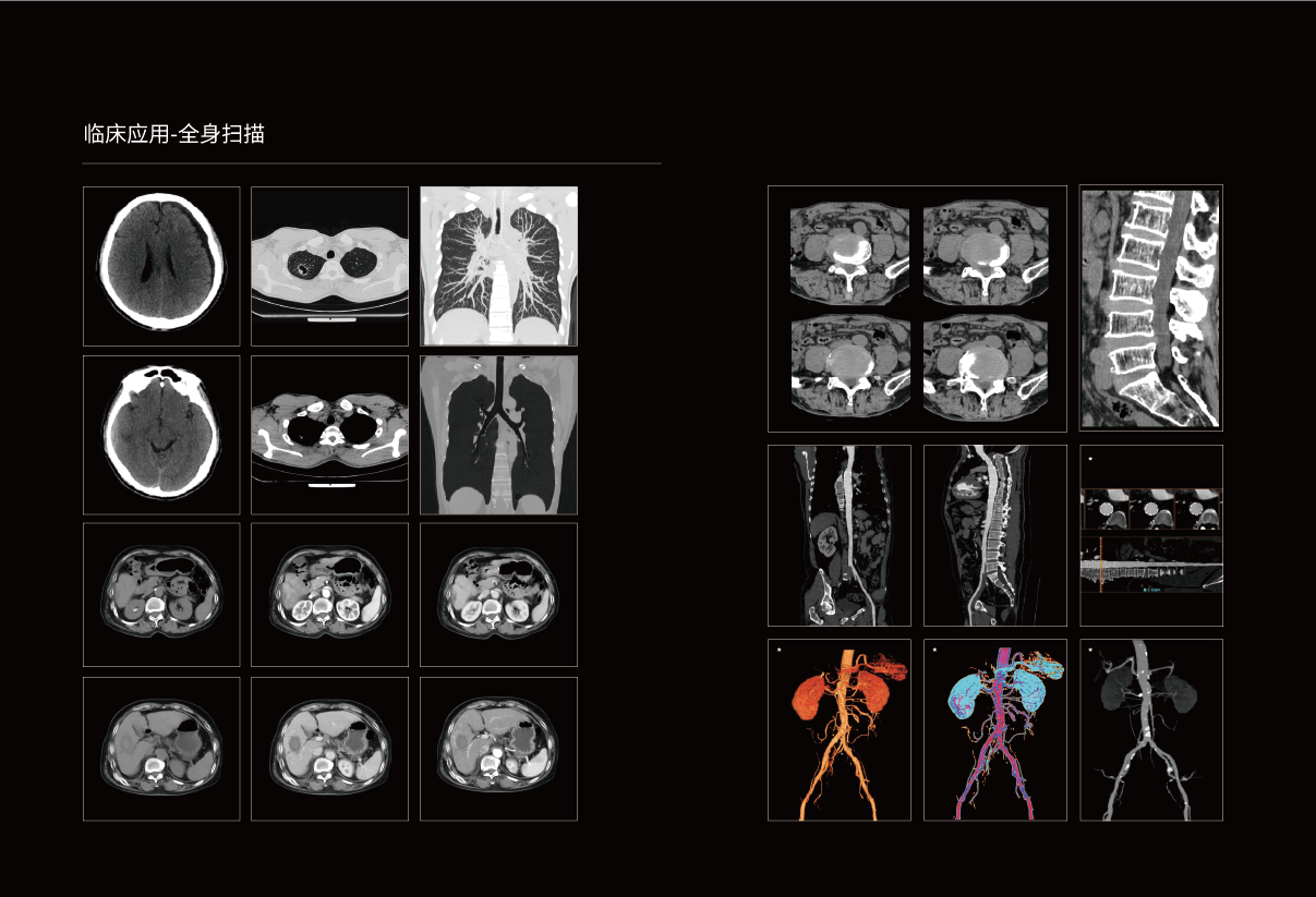 ScintCare CT 32（天穹）.png